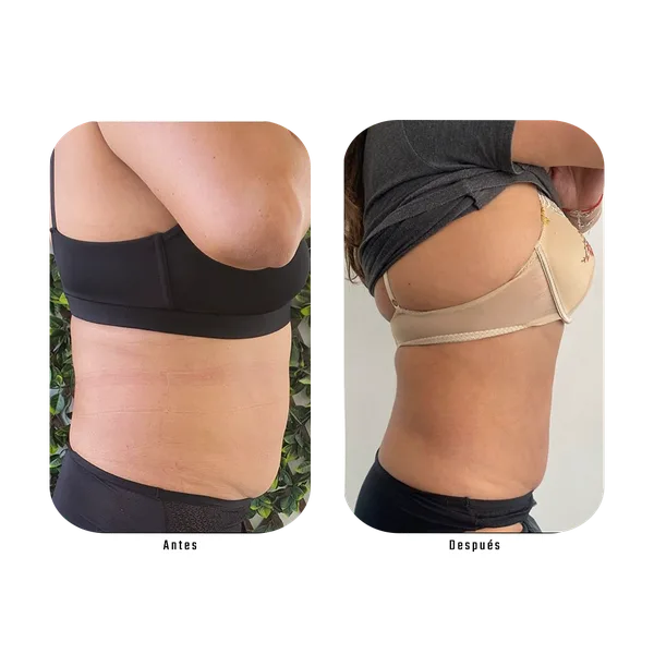 Antes y después — Método Hebe